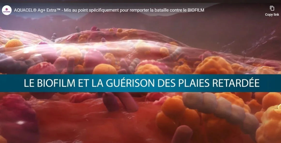 interface utilisateur graphique, texte