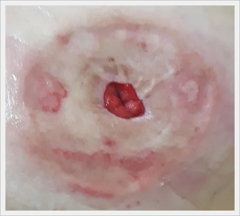 zbliżenie ust osoby